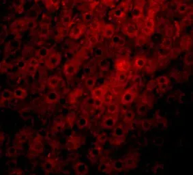 Anti-JMJD1C antibody used in IHC (Paraffin sections) (IHC-P). GTX85014