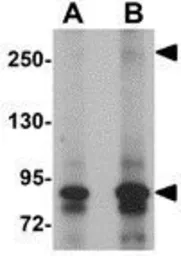 Anti-JMJD1C antibody used in Western Blot (WB). GTX85014