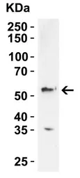 Anti-Occludin antibody used in Western Blot (WB). GTX85016