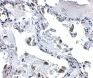 Anti-SH3BP4 antibody used in IHC (Paraffin sections) (IHC-P). GTX85017