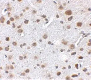 Anti-FTO antibody used in IHC (Paraffin sections) (IHC-P). GTX85019