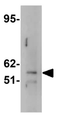 Anti-FTO antibody used in Western Blot (WB). GTX85019