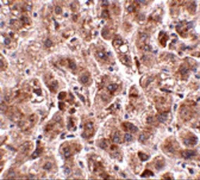 Anti-TREX2 antibody used in IHC (Paraffin sections) (IHC-P). GTX85021