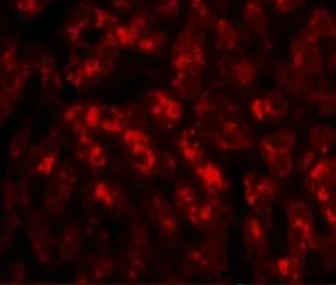 Anti-TREX2 antibody used in IHC (Paraffin sections) (IHC-P). GTX85021