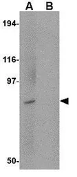 Anti-BICD1 antibody used in Western Blot (WB). GTX85029