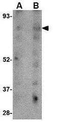 Anti-LIMP II antibody used in Western Blot (WB). GTX85031