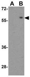 Anti-Slc22A17 antibody used in Western Blot (WB). GTX85032