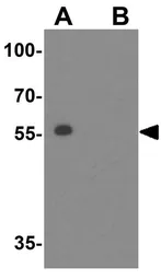 Anti-LIMP II antibody used in Western Blot (WB). GTX85033