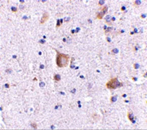Anti-RIM2 antibody used in IHC (Paraffin sections) (IHC-P). GTX85035