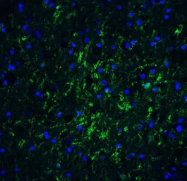 Anti-IRGM antibody used in IHC (Paraffin sections) (IHC-P). GTX85039