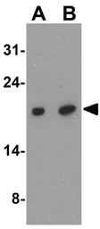 Anti-IRGM antibody used in Western Blot (WB). GTX85039