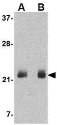 Anti-FGF4 antibody used in Western Blot (WB). GTX85040