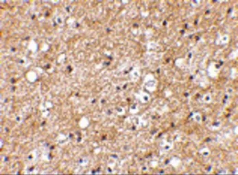 Anti-SP110 antibody used in IHC (Paraffin sections) (IHC-P). GTX85042