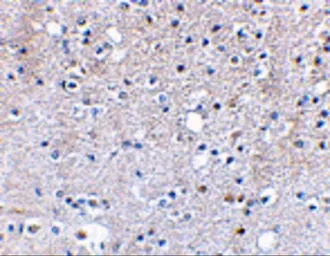 Anti-GRIK5 antibody used in IHC (Paraffin sections) (IHC-P). GTX85043