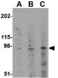 Anti-GRIK5 antibody used in Western Blot (WB). GTX85043