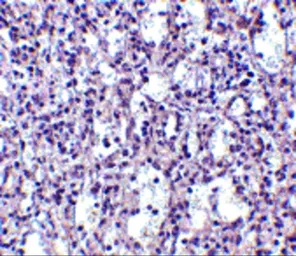 Anti-Carabin antibody used in IHC (Paraffin sections) (IHC-P). GTX85049