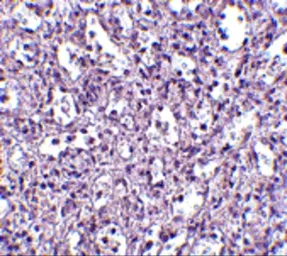 Anti-Carabin antibody used in IHC (Paraffin sections) (IHC-P). GTX85050