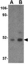 Anti-Carabin antibody used in Western Blot (WB). GTX85050