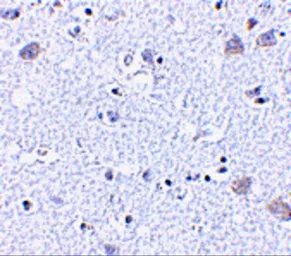 Anti-BRSK1 antibody used in IHC (Paraffin sections) (IHC-P). GTX85054