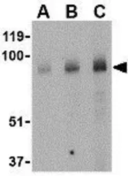 Anti-BRSK1 antibody used in Western Blot (WB). GTX85054