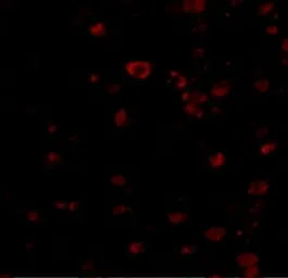 Anti-BRSK1 antibody used in Immunocytochemistry/ Immunofluorescence (ICC/IF). GTX85055