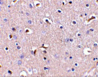 Anti-APH1A antibody used in IHC (Paraffin sections) (IHC-P). GTX85061