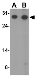 Anti-APH1A antibody used in Western Blot (WB). GTX85061