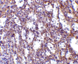 Anti-IL32 antibody used in IHC (Paraffin sections) (IHC-P). GTX85070
