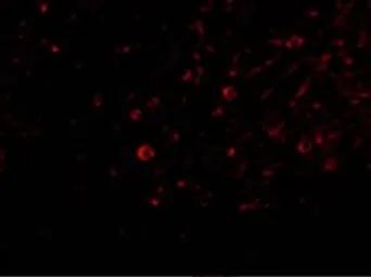Anti-IL32 antibody used in IHC (Paraffin sections) (IHC-P). GTX85070