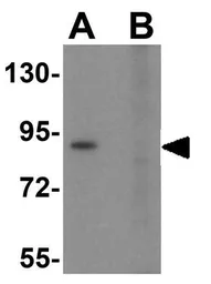 Anti-TLR6 antibody used in Western Blot (WB). GTX85075