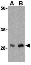 Anti-CTRP1 antibody used in Western Blot (WB). GTX85079