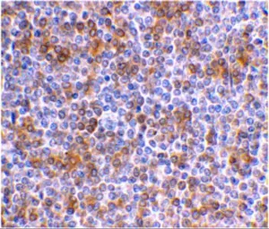 Anti-APOBEC3G antibody used in IHC (Paraffin sections) (IHC-P). GTX85084