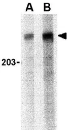 Anti-PARC antibody used in Western Blot (WB). GTX85085