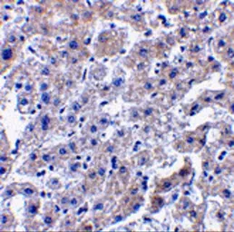 Anti-Caspase 14 antibody used in IHC (Paraffin sections) (IHC-P). GTX85087