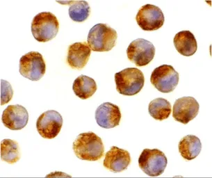 Anti-IL21 antibody used in Immunocytochemistry/ Immunofluorescence (ICC/IF). GTX85088