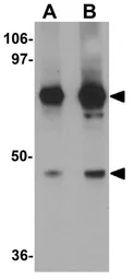 Anti-FAM82A1 antibody used in Western Blot (WB). GTX85107