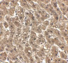 Anti-Her2 / ErbB2 antibody used in IHC (Paraffin sections) (IHC-P). GTX85113