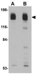 Anti-Her2 / ErbB2 antibody used in Western Blot (WB). GTX85113