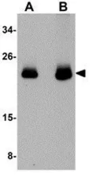 Anti-CDC42 antibody used in Western Blot (WB). GTX85114