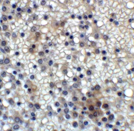Anti-MD2 antibody [1A2E3] used in IHC (Paraffin sections) (IHC-P). GTX85121