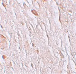 Anti-SLC39A7 antibody used in IHC (Paraffin sections) (IHC-P). GTX85130