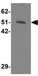 Anti-SLC39A7 antibody used in Western Blot (WB). GTX85130
