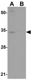 Anti-ZIP3 antibody used in Western Blot (WB). GTX85133