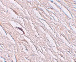 Anti-SLC39A2 antibody used in IHC (Paraffin sections) (IHC-P). GTX85134