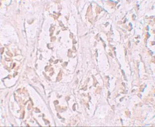 Anti-STOX2 antibody used in IHC (Paraffin sections) (IHC-P). GTX85136