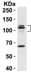 Anti-PEAR1 antibody used in Western Blot (WB). GTX85138