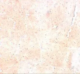 Anti-SYNPO2 antibody used in IHC (Paraffin sections) (IHC-P). GTX85139