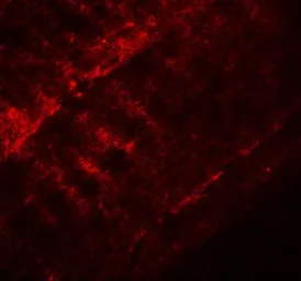 Anti-SYNPO2 antibody used in IHC (Paraffin sections) (IHC-P). GTX85139