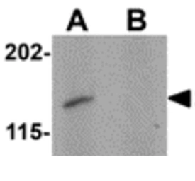 Anti-SYNPO2 antibody used in Western Blot (WB). GTX85139