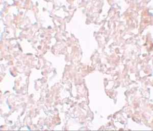 Anti-MFSD1 antibody used in IHC (Paraffin sections) (IHC-P). GTX85148